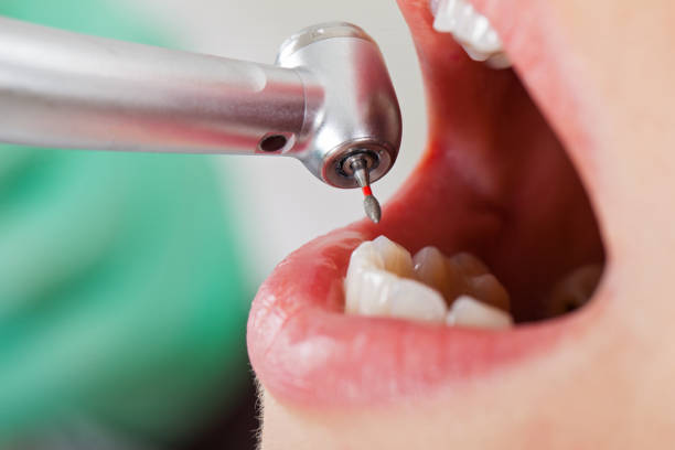 Best Emergency Treatment for Toothache in Watertown, WI
